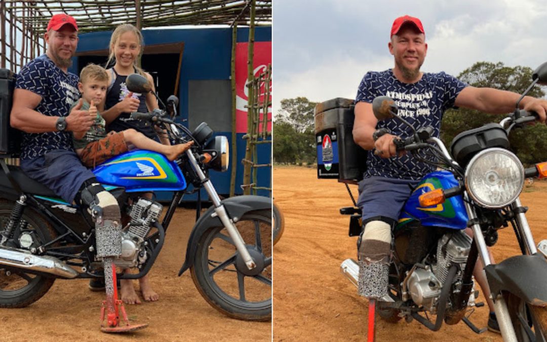 FEEL GOOD | Biker Friends to Ride to Lesotho on Delivery Bikes to give man a professional prosthetic leg