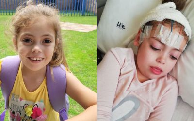 Community rallies to help nine-year-old Miane Swart overcome seizures