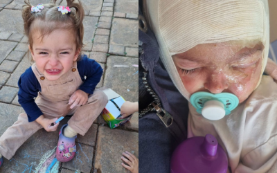 Tragic Accident Leaves 21-Month-Old Baby Ellané with Severe Burns: Family Seeks Support for Her Long Road to Recovery