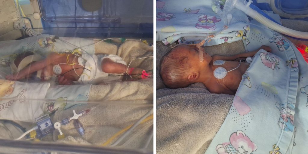 Selena and Leona NICU Warriors