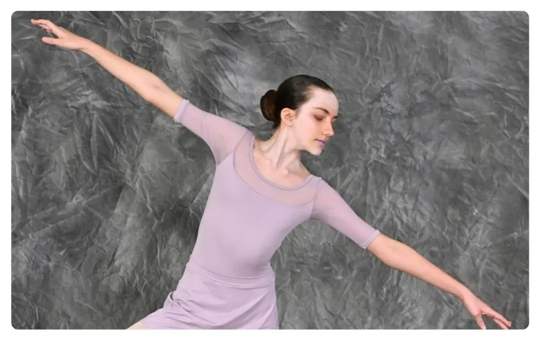 Press Release: Durban Girl’s Dream to Dance at Risk as Family Seeks Urgent Support for Scoliosis Treatment