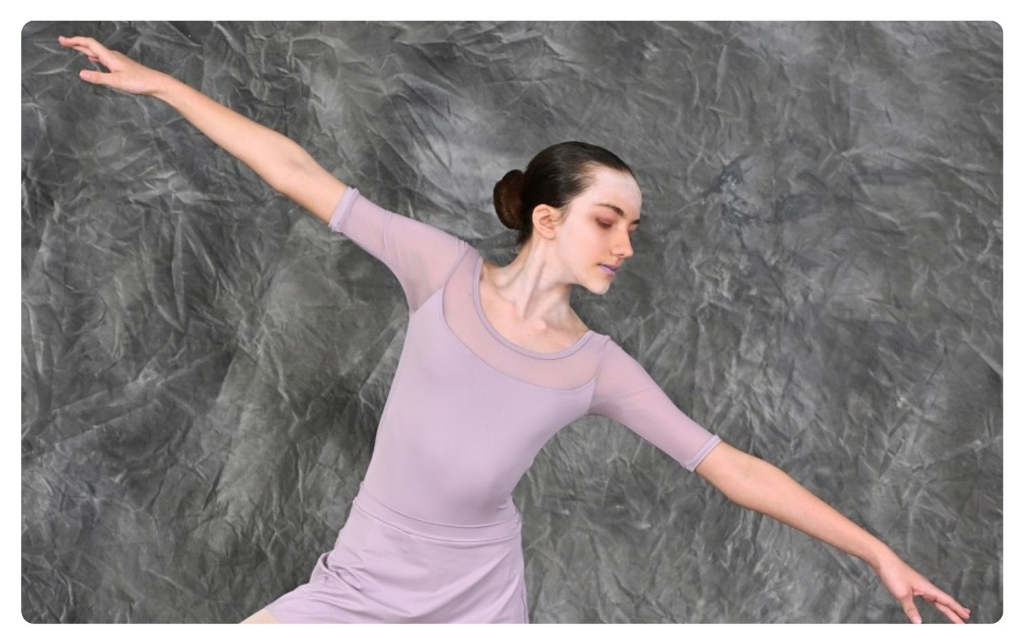 dancer 2 Scoliosis brace crowdfunding campaign helping young Durban ballet dancer Carley access urgent treatment