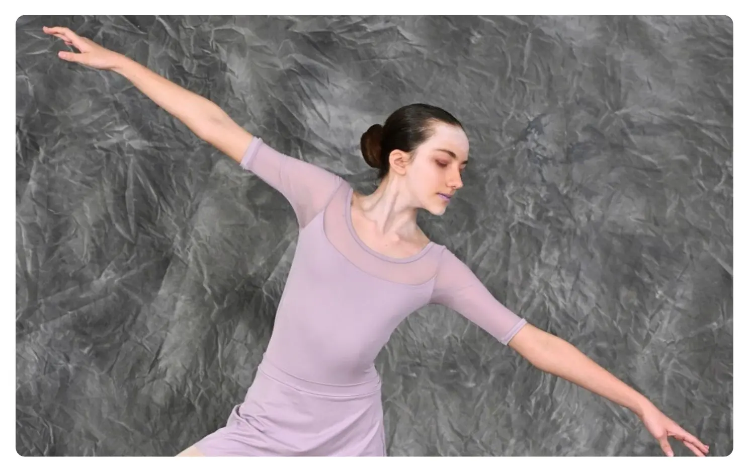 Scoliosis brace crowdfunding campaign helping young Durban ballet dancer Carley access urgent treatment