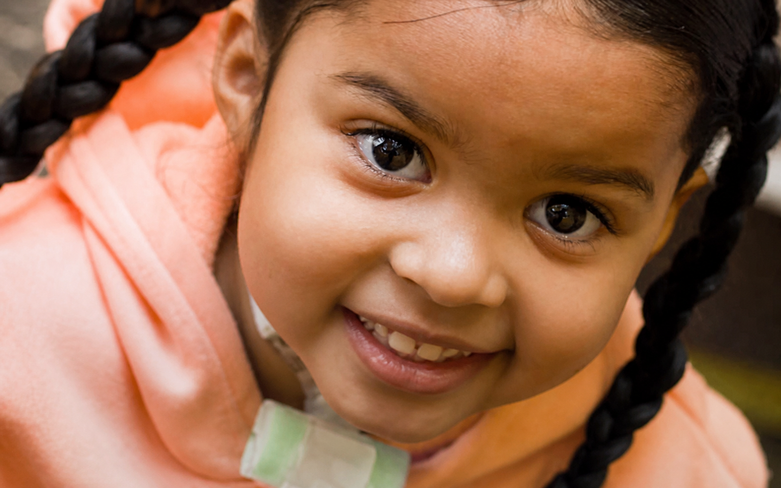 Three-year-old Jude smiling while her family raises funds for airway reconstruction